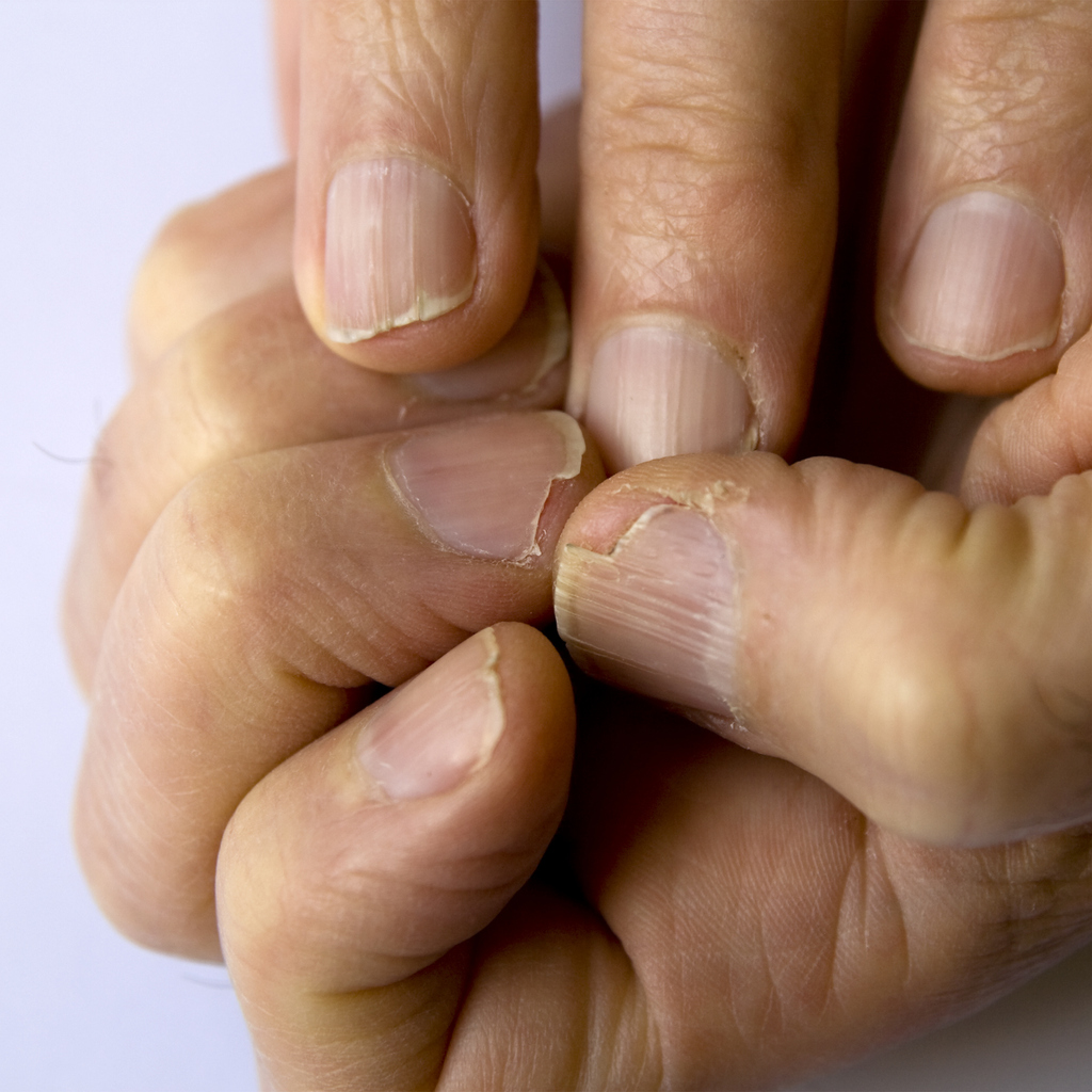How to Repair a Nail Split Down the Middle